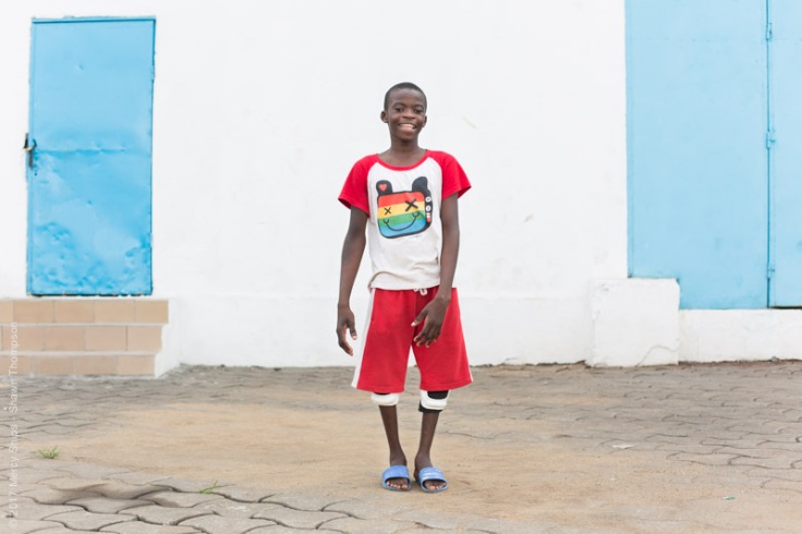 Ulrich, orthopedic patient, stands joyfully with his newly straightened legs.